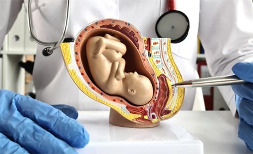 कृत्रिम गर्भनाल : समयपूर्व जन्मिने शिशुको नयाँ जीवनरेखा